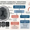هماتوم ساب‌دورال مزمن – مدیریت داروهای ضدانعقاد و عوارض ترومبوتیک