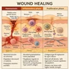 فرآیند ترمیم زخم: مروری بر سازوکارهای سلولی و مولکولی